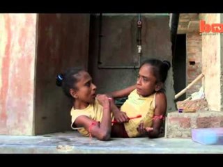 E RRALLE NE BENGAL,MOTRAT SIAMEZE 45 VJECARE MARTOHEN ME NJE 36 VJECAR QE KUJDESET PER TO LAJM