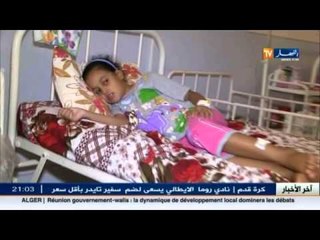 اصابة عشرات الأشخاص بحالة تسمم غذائي بمليانة