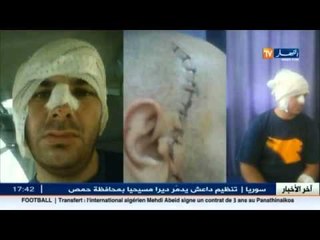 مواطن يتعرض لاعتداء بمستشفى مشدالة في البويرة