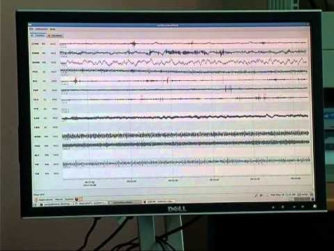 LEKUNDJE TE FORTA TERMETI GJATE MENGJESIT TE SE SHTUNES EPIQENDRA NE KURBNESH LAJM