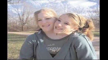 a beautiful girl has two head in austrailia