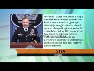 SHBA, ushtria “shpërndan” kampionë antraksi nëpër laboratorë - Top Channel Albania - News - Lajme