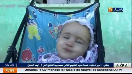 برائة وُلدت دون يدين  مايا ذات 17 شهرا تنتظر مساعدة لزرع يدين اصطناعيتين