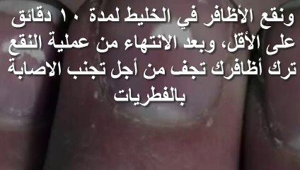 وصفة زيت اللافندر لعلاج بقع الاظافر البيضاء