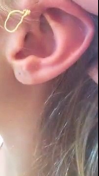 Elle perce un bouton à l'oreille vieux de 6 ans... Beurk !!