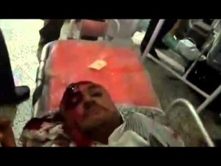 JEMENI NE FLAKE SHKARKOHET QEVERIA,NJE GJENERAL KALON ME OPOZITEN LAJM