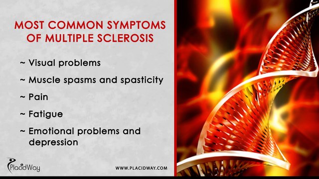 Innovative Stem Cell Treatment for Multiple Sclerosis in Europe