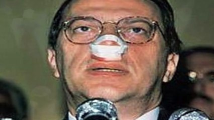 Türkiyede Saldırıya Uğramış 10 Politikacı