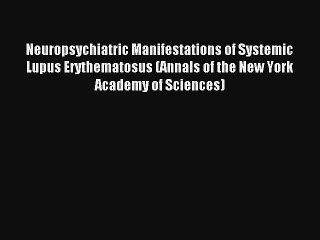 Neuropsychiatric Manifestations of Systemic Lupus Erythematosus (Annals of the New York Academy