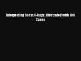 Interpreting Chest X-Rays: Illustrated with 100 Cases  Online Book