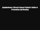 Lymphedema: A Breast Cancer Patient's Guide to Prevention and Healing