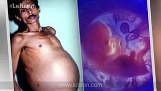 Unbelievable and Amazing | Man Born a Baby in India