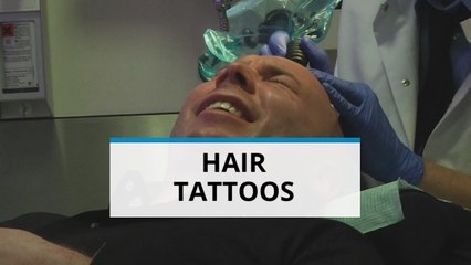 Hair tattoos, the ultimate solution to baldness