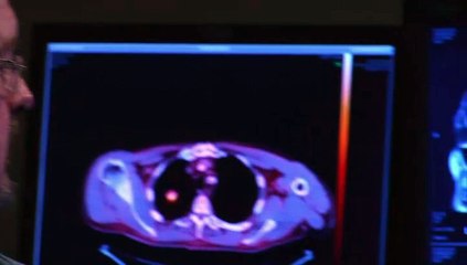 Food Source for Brain Cells