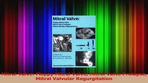 Mitral Valve Floppy Mitral Valve Mitral Valve Prolapse Mitral Valvular Regurgitation Download