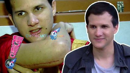 Parah, Tangan Susah Bergerak Stuart Merintih - Cumicam 04 Desember 2015