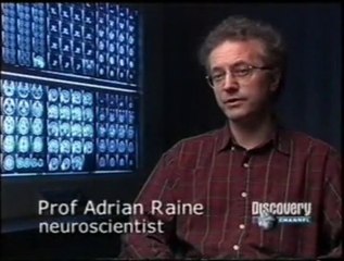 Cerebro: Violencia y maltrato infantil (Lóbulo frontal)