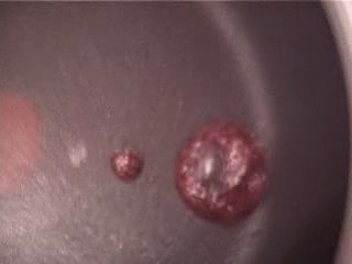 Blonde Redhead - My clip of Elephant Wom