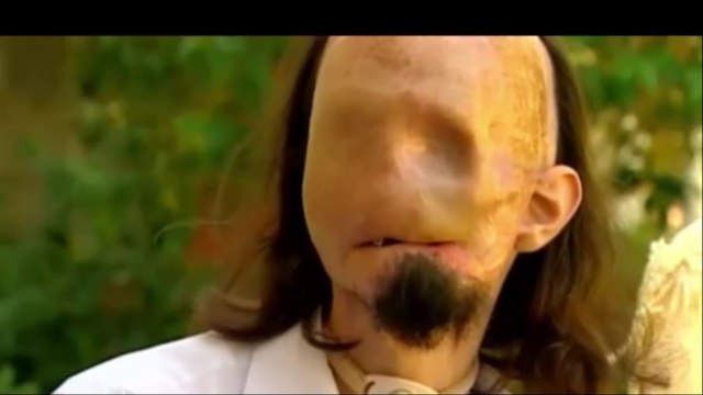 Man Loses His Face In Electrocution Accident ,special interview with this man and his family