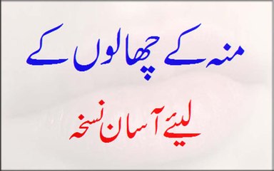 Moo Ke Chalon Ke Liye Asan Nuskha