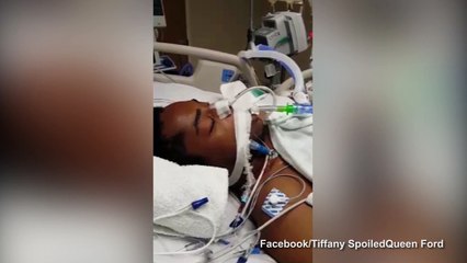 Desperate mom asks for prayers after teen son shot by police