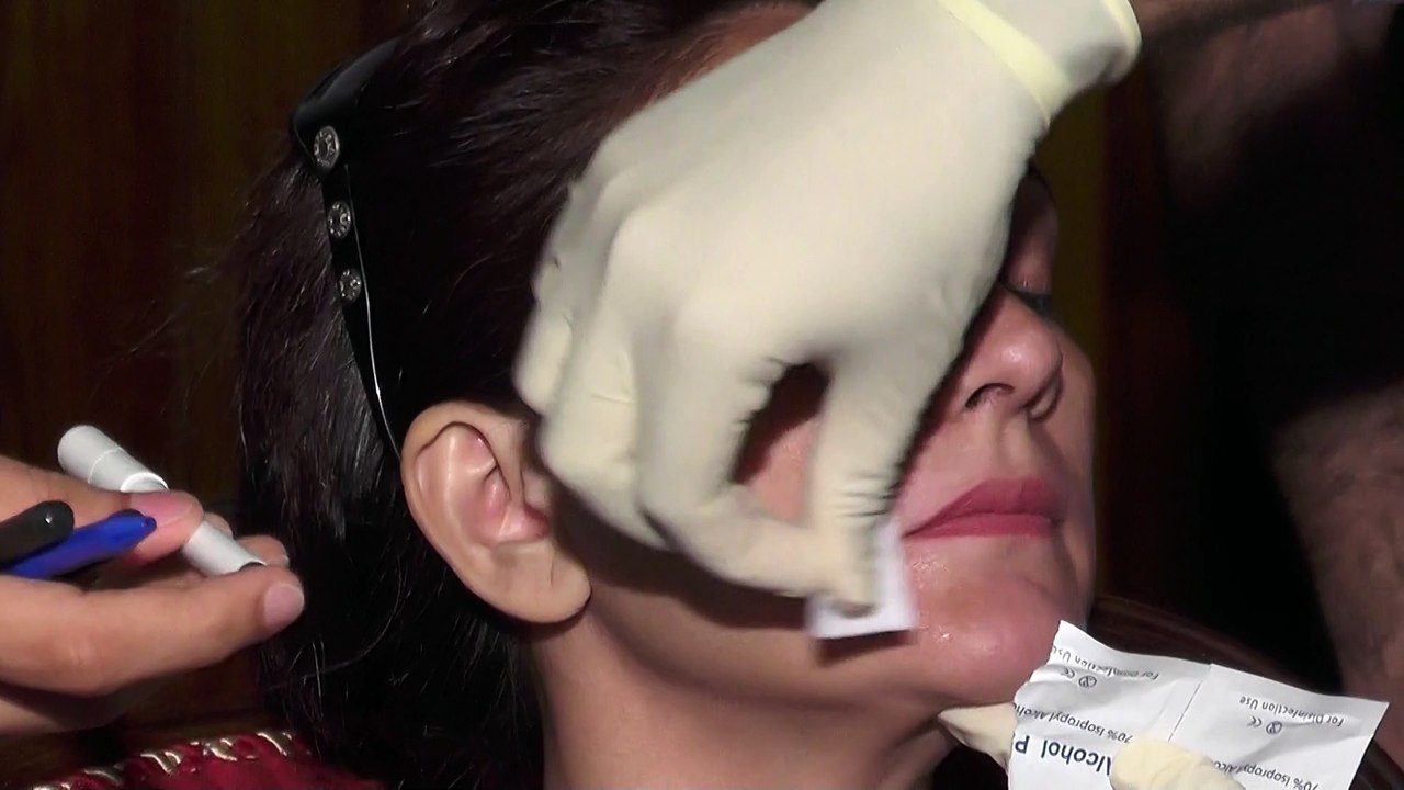 Dr Haroon nabi & Dr Mozzam N tarer Fillers work shop Part 18