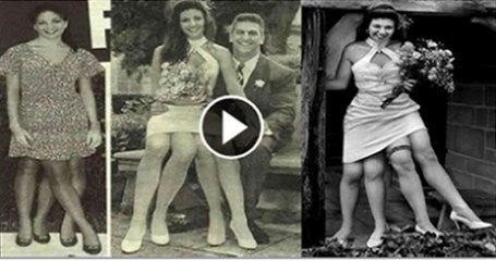 The four legged woman