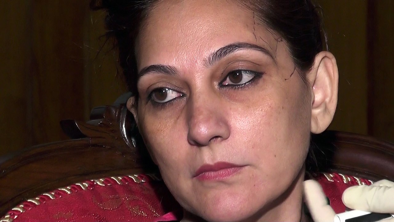 Dr Haroon nabi & Dr Mozzam N tarer Fillers work shop Part 19