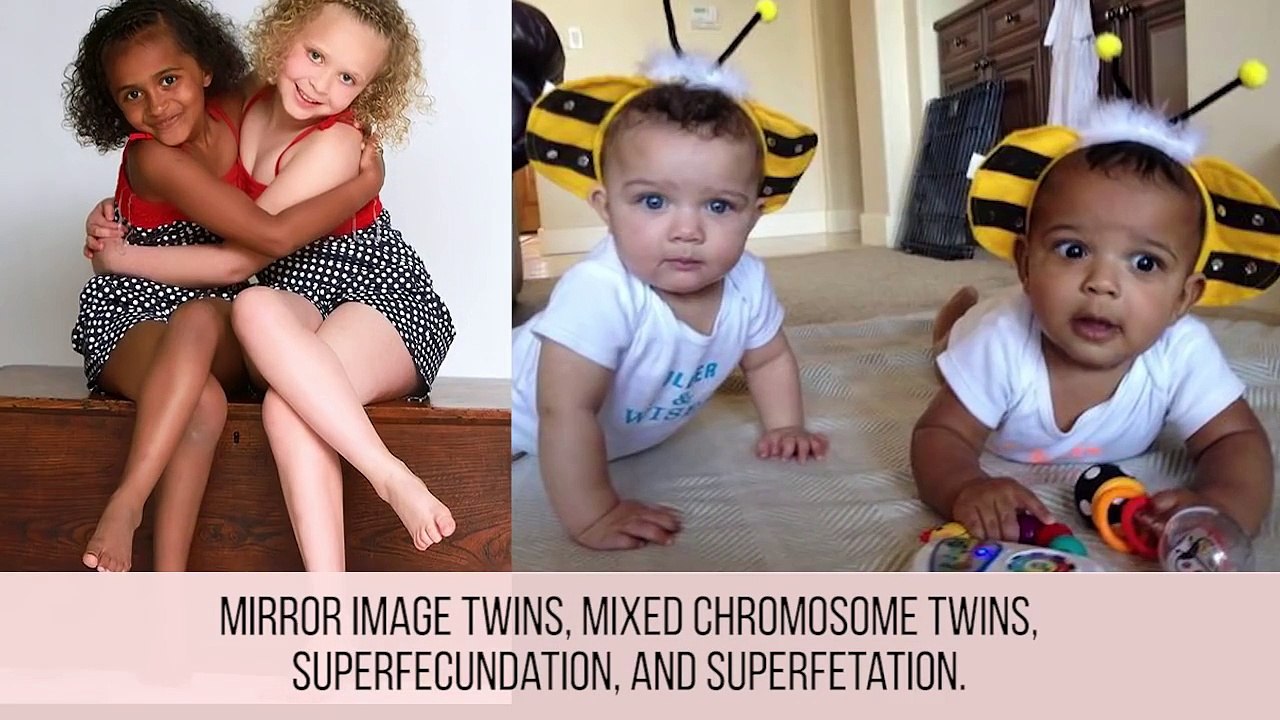 10 Amazing Facts About Twins