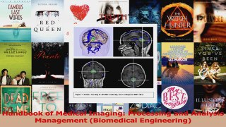 Handbook of Medical Imaging Processing and Analysis Management Biomedical Engineering Download Full Ebook