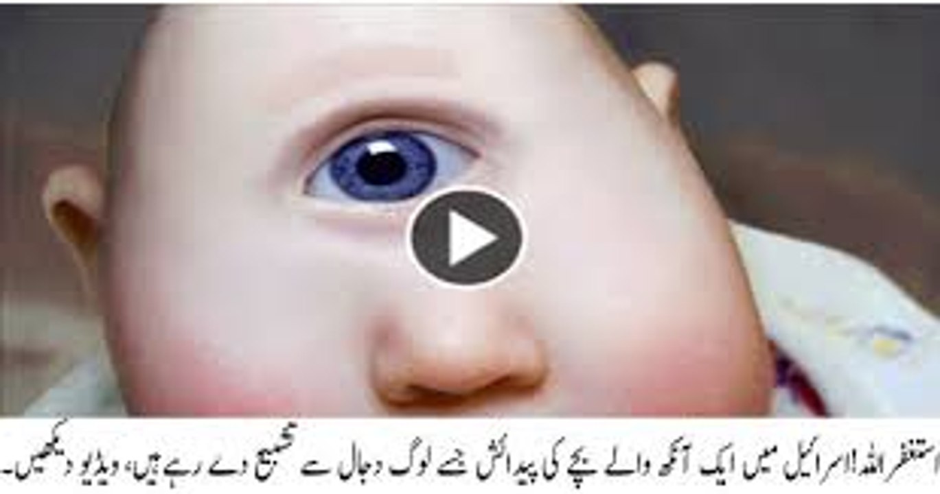 One Eyed baby born in Israel-Shocking.. Must watch