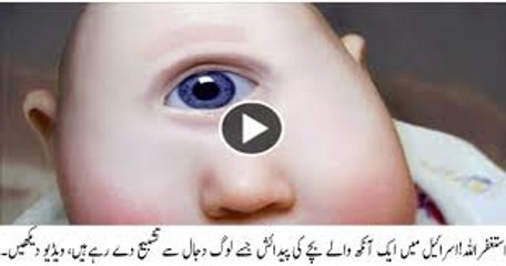 One Eyed baby born in Israel-Shocking.. Must watch