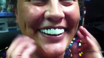 The MOST AMAZING Snap On Smile Alternative Before and After!!!