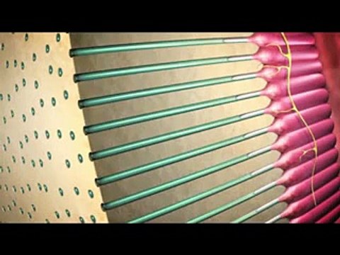 Coorparoo Dentists - Video on Understanding Tooth Sensitivity