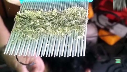 Is This The Worst Case Of Head Lice In The Entire World?! This Is So Rank