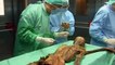 World's oldest mummified corpse had tummy bug