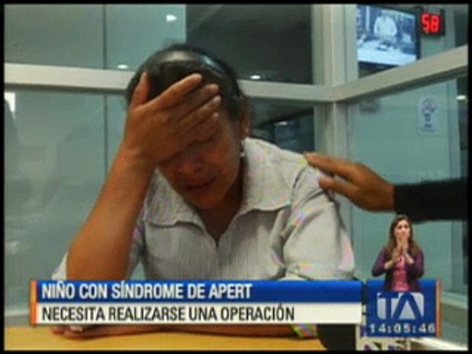 Niño con síndrome de Apert necesita realizarse una operación
