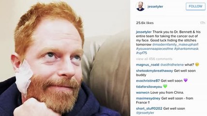 Jesse Tyler Ferguson le agradece a los doctores por 'removerle el cáncer' de su rostro