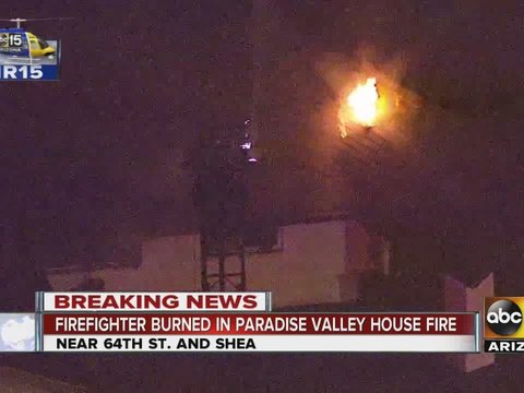 Firefighter burned while extinguishing flames