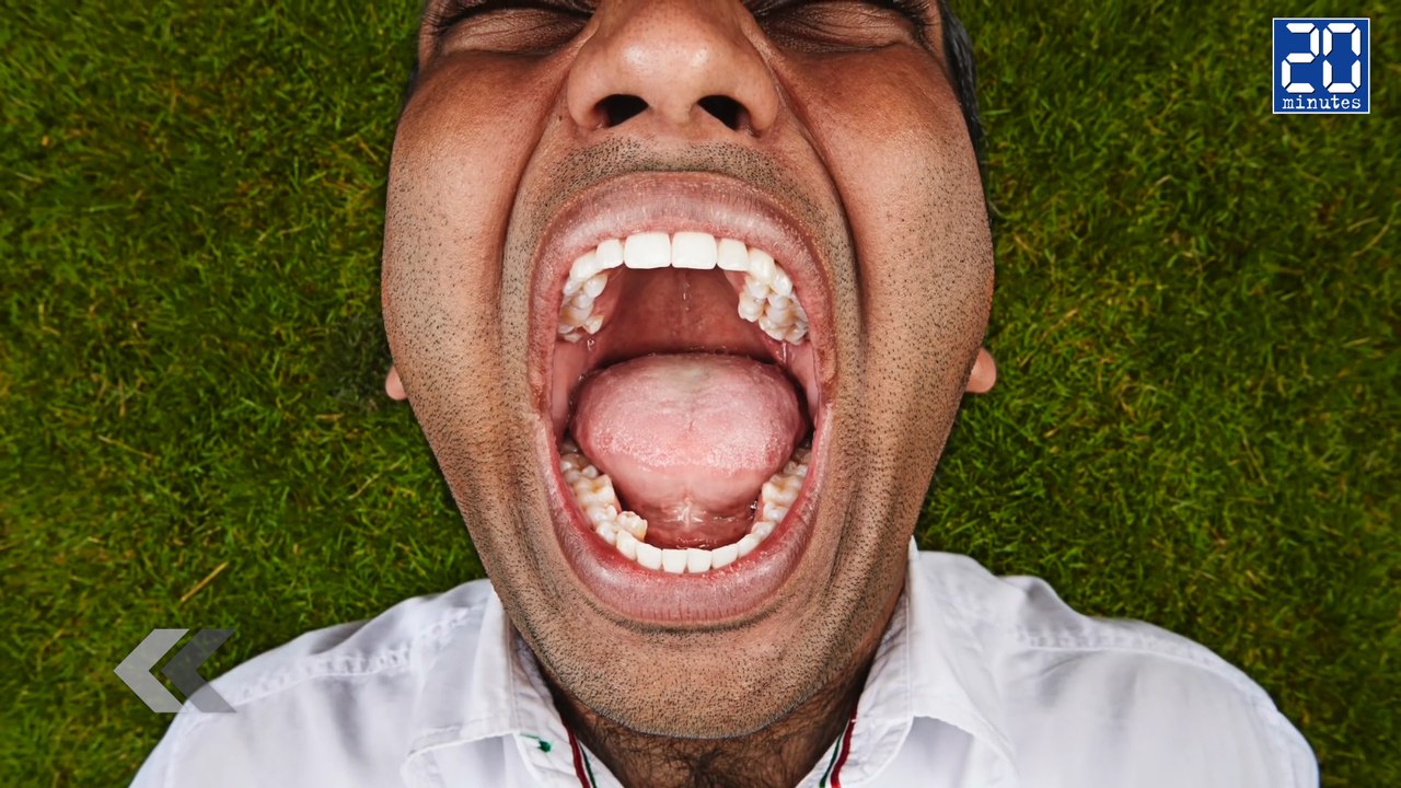 Cet homme a le plus de dents au monde - Le rewind du jeudi 10 décembre 2015.