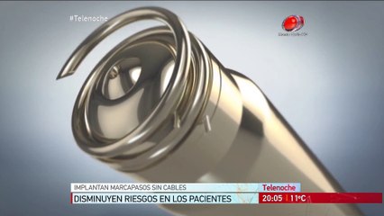 Avances en salud : Implantan marcapasos sin cable.