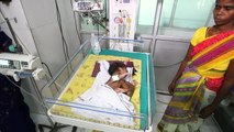 Indian Baby Born with Parasitic Twin Joined to Stomach