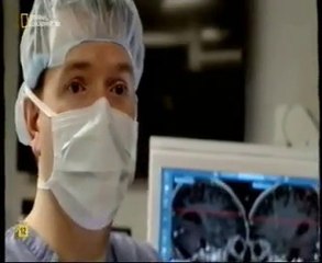 Cirugia de la epilepsia: Estimulacion cerebral hipocampal (Mohamad Koubeissi)