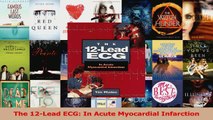 Download  The 12Lead ECG In Acute Myocardial Infarction Ebook Online