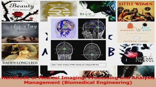 PDF Download  Handbook of Medical Imaging Processing and Analysis Management Biomedical Engineering Read Full Ebook