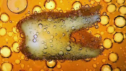 Kola İçmenin Diş Üzerindeki Etkisi