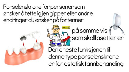 Porselenskrone - billig tannlege Oslo