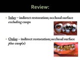 Materials for Inlays, Onlays, Crowns and Bridges