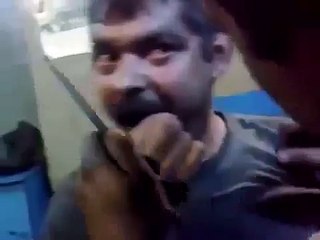 Смешное видео. Лечение зубов!!!