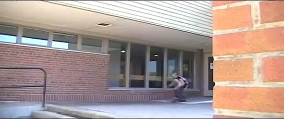 kickflip to broken nose